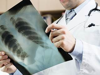 Retired and sadly diagnosed with a fatal mesothelioma condition